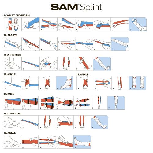 Шина іммобілізаційна (медична) SAM® "Splint II NAR® 36 in. Flatfold", 50-1005